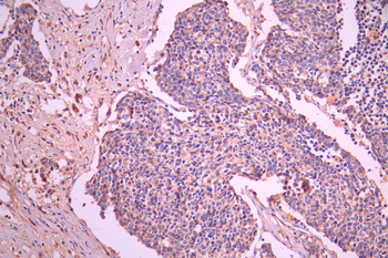 VPS11 Antibody