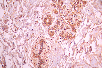 WAPL Antibody