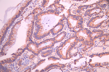 TSC2 Antibody