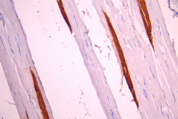 TNNI1 Antibody