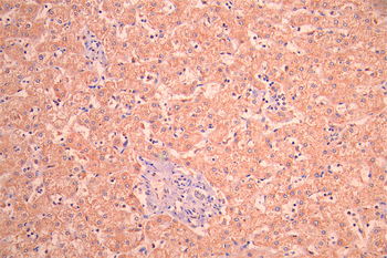HTRA2 Antibody