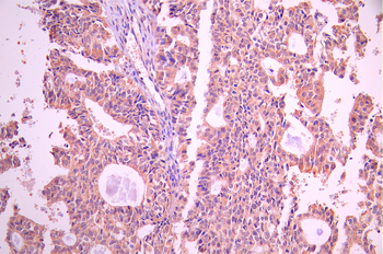 HTRA2 Antibody