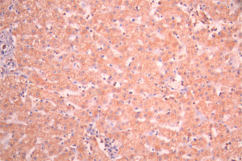 ENTPD5 Antibody