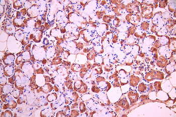 PIP Antibody