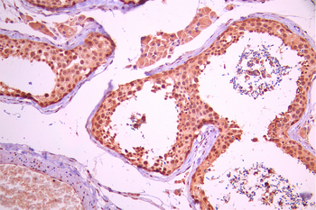 HSF2 Antibody