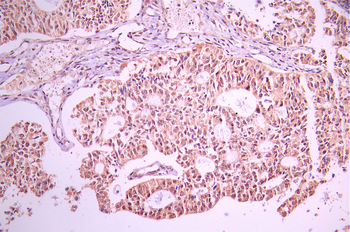 HSF2 Antibody