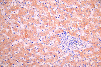 PON1 Antibody