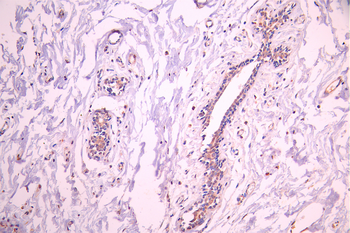 PON1 Antibody