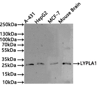 LYPLA1 Antibody