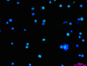 LYPLA1 Antibody