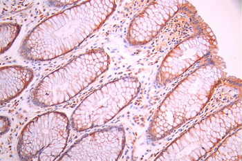 AP2S1 Antibody