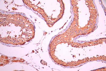 PGK1 Antibody