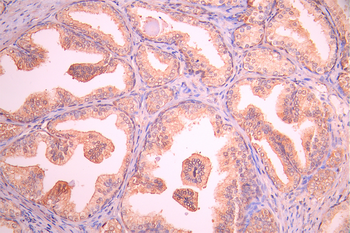 PGK1 Antibody