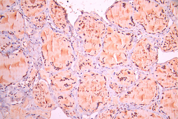 IRF9 Antibody