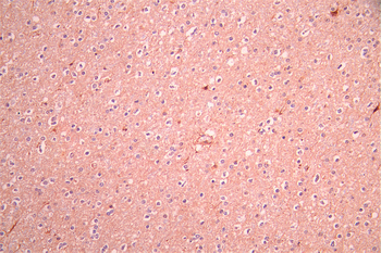 DKK3 Antibody