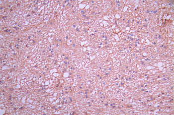 DKK3 Antibody