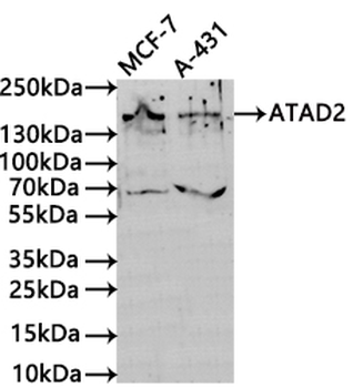 ATAD2 Antibody
