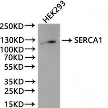 ATP2A1 Antibody