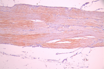 ACTN2 Antibody