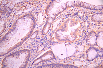 ACTN2 Antibody