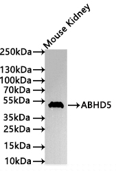 ABHD5 Antibody