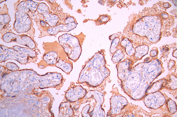 CSH2/CSH1 Antibody