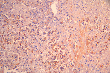 CSH2/CSH1 Antibody