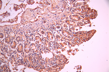 NRAS Antibody