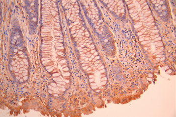 NRAS Antibody