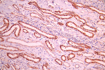 CDH16 Antibody