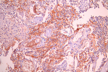 CDH16 Antibody