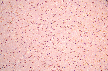 PSMD4 Antibody