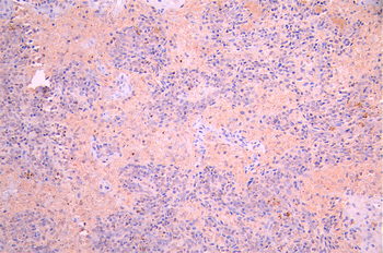 CXCR5 Antibody