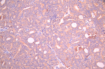 CXCR5 Antibody