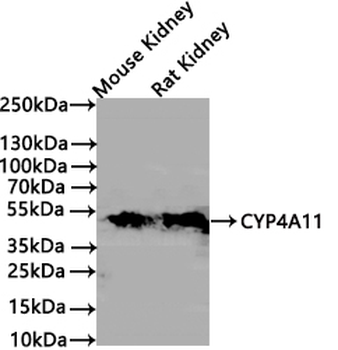 CYP4A11 Antibody