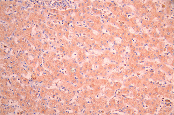 CYP4A11 Antibody