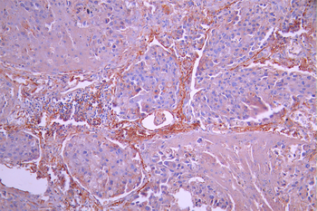 CYP4A11 Antibody