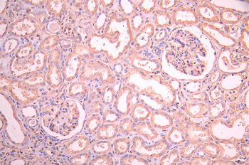 B2M Antibody