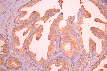 B2M Antibody