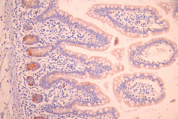 RAB4A Antibody