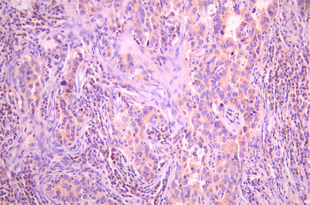 RAB4A Antibody