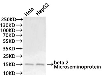 MSMB Antibody