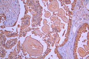 MSMB Antibody