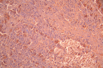 ABCD3 Antibody
