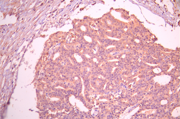 GNL3 Antibody