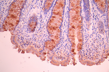 SLC3A2 Antibody