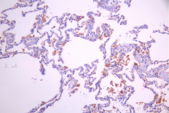 PLXNA1 Antibody