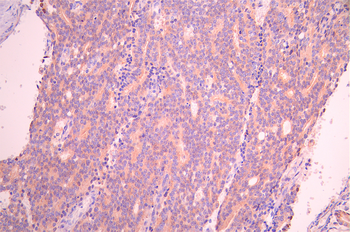 PLXNA1 Antibody