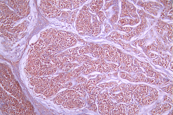 KAT2B Antibody