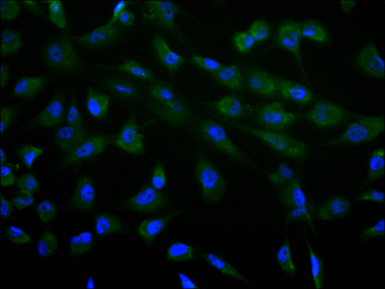 KAT2B Antibody